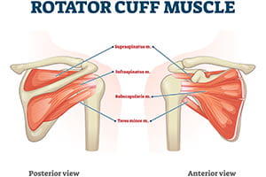 Rotator cuff Denver Health