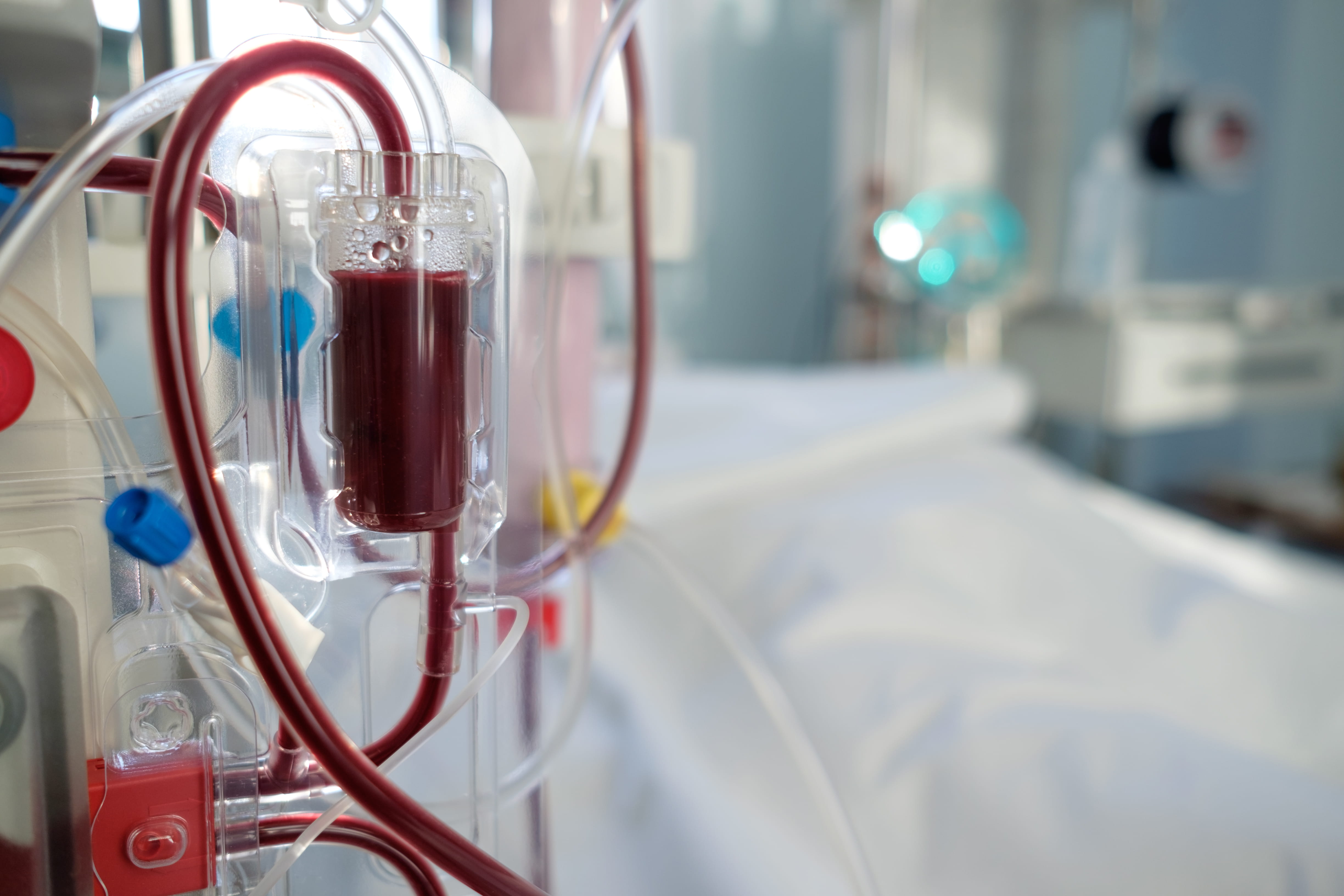 Leading the Way in Kidney Dialysis Research Denver Health