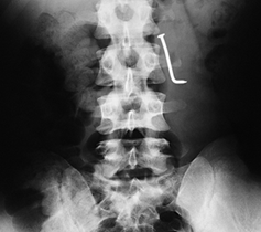 X-Ray of Human Body