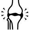 Knee joint illustration showing femur and tibia