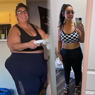 Denver Health bariatric patient Felicia Vasquez is shown before and after her weight loss surgery.