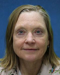 Jennifer Ess, M.D. Jennifer Ess, M.D.