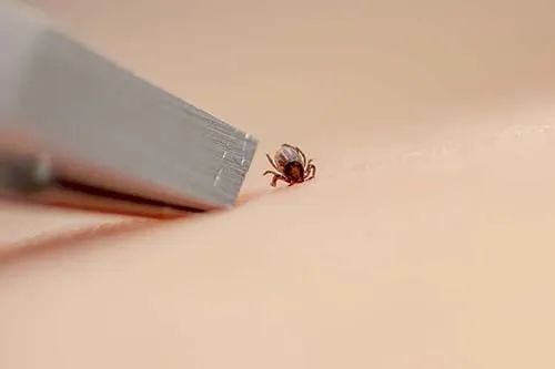 A close-up of tweezers about to pinch a that is on someone's skin.