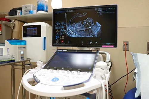 A GE Healthcare Voluson ultrasound machine
